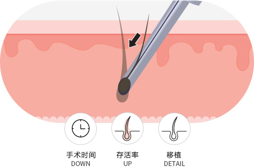 前后照片