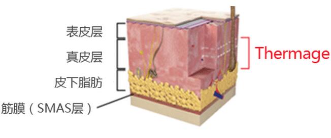 原辰激光提升热玛吉