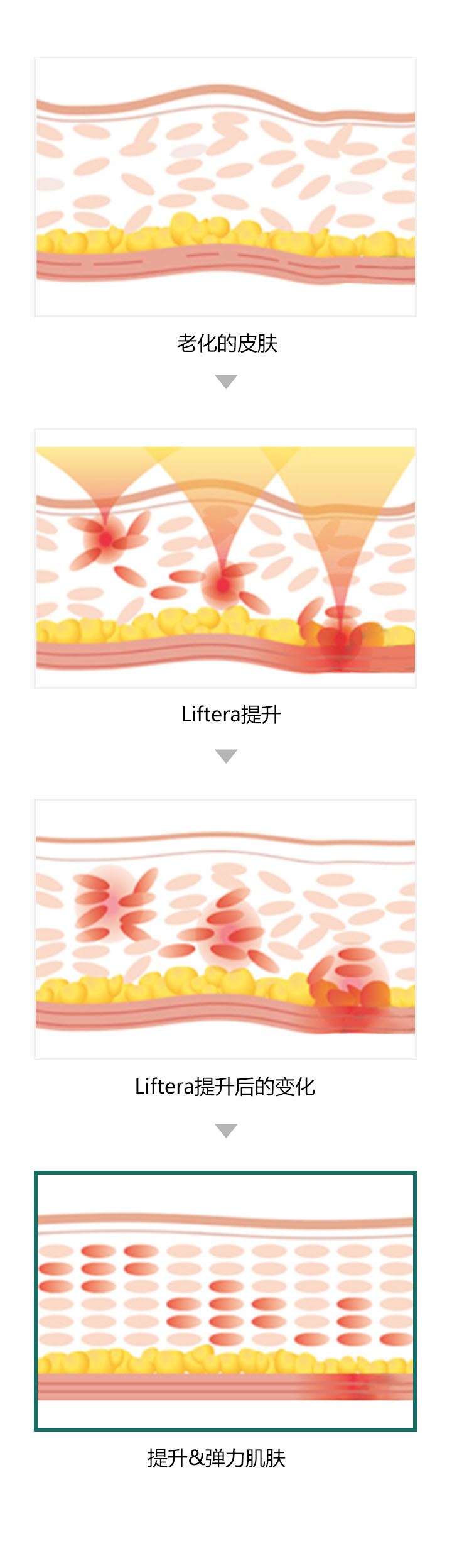 热立塑能量分层传导示意图