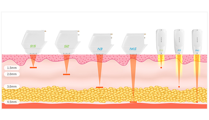 多深度治疗头组