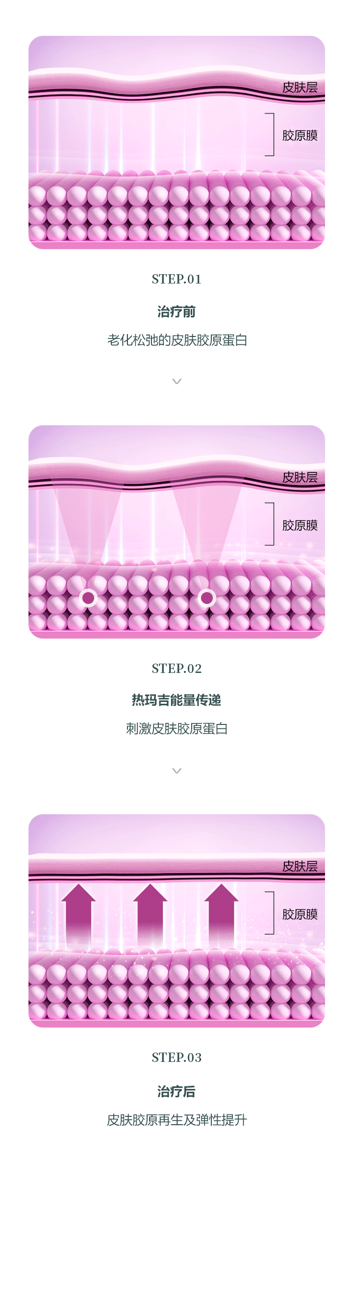 热玛吉胶原再生机制图示