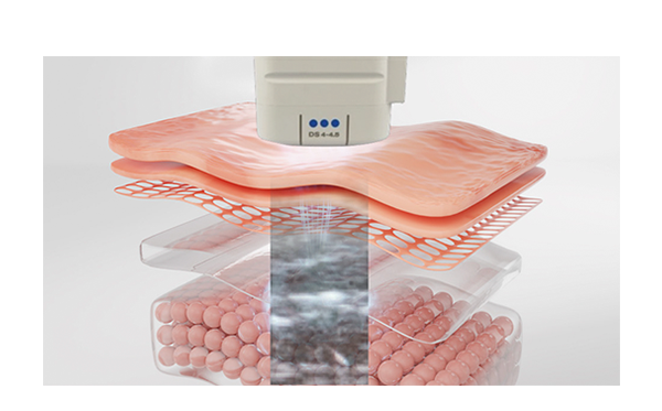 超声刀能量传递路径示意图