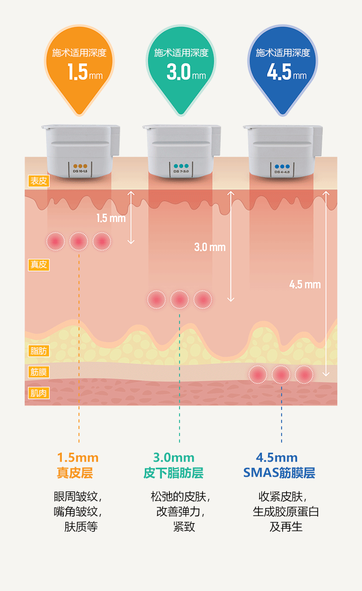皮肤分层治疗示意图