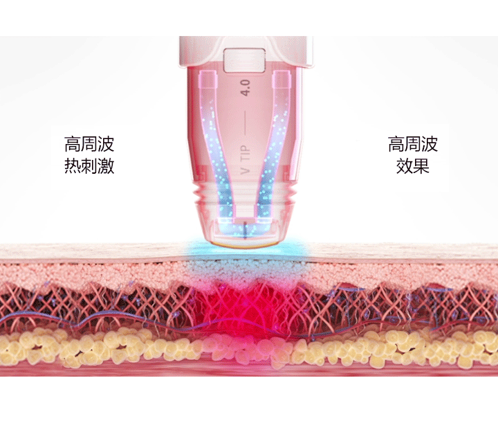 WJ原辰的VOLNEWMER提升原理